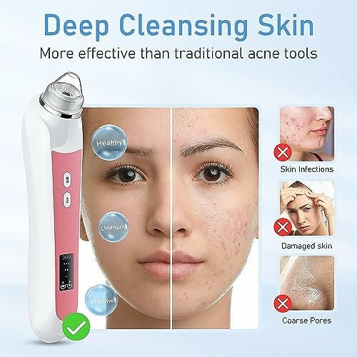 Facial cleansing device comparison showing skin improvement.