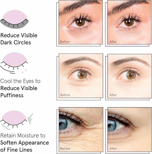 Comparison of eye skin treatment results before and after.