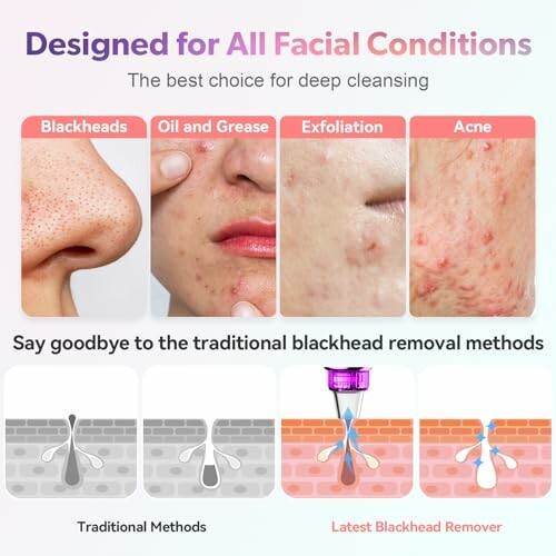 Facial conditions and blackhead removal methods comparison.