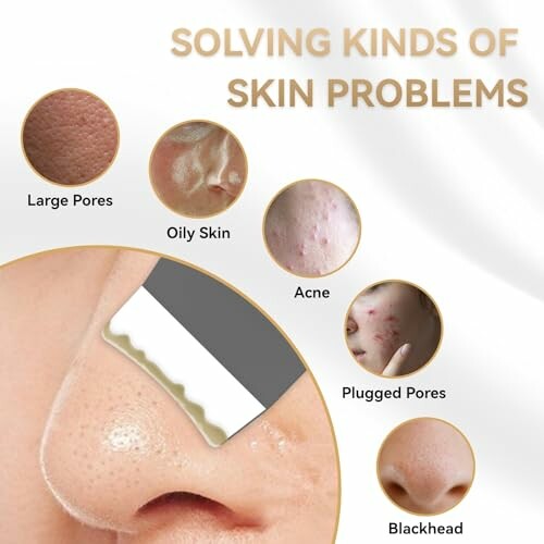 Image showing solutions for skin problems like large pores, oily skin, acne, plugged pores, and blackheads.