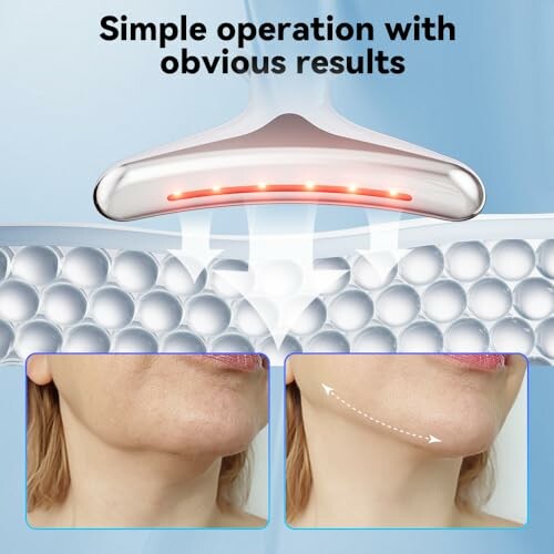 Skin tightening device with before and after results.